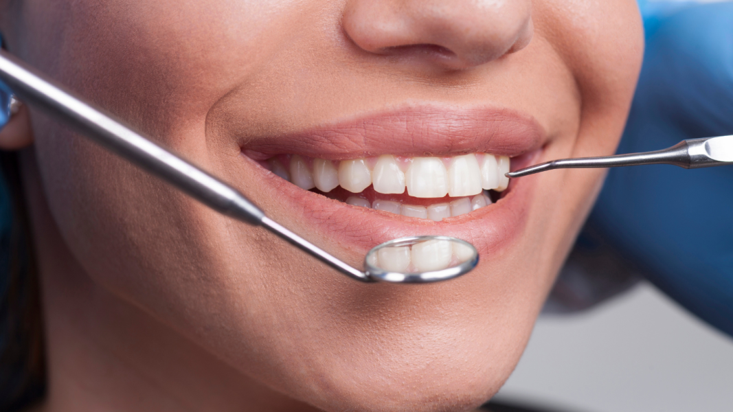 odontoprev-banco-bradescard-e-casas-bahia-fecham-parceria-e-ampliam-acesso-a-saude-bucal